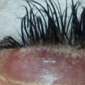 What Causes Eyelash Extensions to Fall Out?